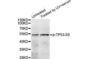 Western Blotting (WB) image for anti-Tumor Protein P53 (TP53) (pSer9) antibody (ABIN1870676) (p53 抗体  (pSer9))