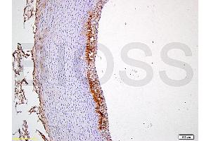 Formalin-fixed and paraffin embedded rabbit carotid artery tissue labeled with Anti-CD54/ICAM-1 Polyclonal Antibody, Unconjugated (ABIN707606) at 1:400 followed by conjugation to the secondary antibody and DAB staining (ICAM1 抗体  (AA 451-505))