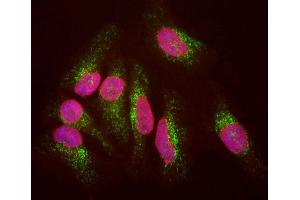 HeLa cells staining with ABIN1580432 (green), and counterstained with ’s chicken polyclonal antibody to Lamin A/C, CPCA-LaminAC (red) and DNA (blue). (LAMP1 抗体)