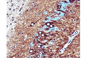 Catalytic alpha (clone 46) staining on rat brain. (PP2A Catalytic alpha (AA 153-309) 抗体)