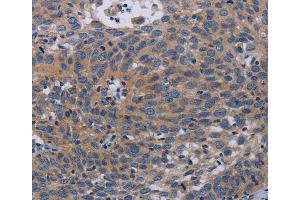 Immunohistochemistry (IHC) image for anti-Pregnancy-Associated Plasma Protein A, Pappalysin 1 (PAPPA) antibody (ABIN2433527) (PAPPA 抗体)