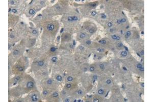 DAB staining on IHC-P; Samples: Human Liver Tissue (NPPC 抗体  (AA 33-125))