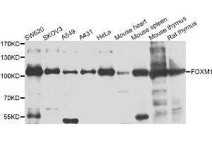 Western blot analysis of extracts of various cell lines, using FOXM1 antibody. (FOXM1 抗体)
