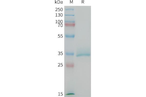 CGRP Protein (AA 83-119) (Fc Tag)