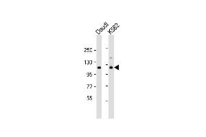 Western Blot at 1:1000 dilution Lane 1: Daudi whole cell lysate Lane 2: K562 whole cell lysate Lysates/proteins at 20 ug per lane. (STAT2 抗体  (C-Term))