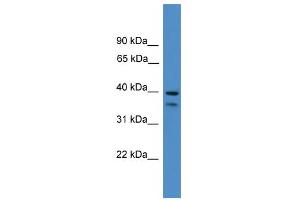 WB Suggested Anti-SERPINB6 Antibody Titration: 0. (SERPINB6 抗体  (Middle Region))