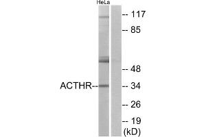 Western blot analysis of extracts from HeLa cells, using ACTHR antibody. (MC2R 抗体  (C-Term))