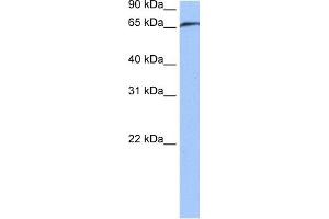 WB Suggested Anti-RABGGTA Antibody Titration:  0. (RABGGTA 抗体  (N-Term))