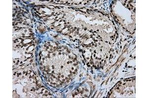 Immunohistochemical staining of paraffin-embedded pancreas tissue using anti-DAPK2 mouse monoclonal antibody. (DAPK2 抗体)