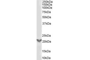 Western Blotting (WB) image for anti-TGFB-Induced Factor Homeobox 2 (TGIF2) (Internal Region) antibody (ABIN2466365) (TGIF2 抗体  (Internal Region))