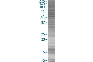 RARG transfected lysate. (RARG 293T Cell Transient Overexpression Lysate(Denatured))