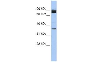 MGC48628 antibody used at 1 ug/ml to detect target protein. (MGC48628 (N-Term) 抗体)