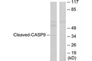 Western Blotting (WB) image for anti-Caspase 9, Apoptosis-Related Cysteine Peptidase (CASP9) (AA 281-330), (Cleaved-Asp330) antibody (ABIN2891160) (Caspase 9 抗体  (Cleaved-Asp330))