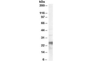 Western blot testing of human brain lysate with PrP antibody at 0. (PRNP 抗体)