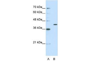 THEX1 antibody used at 2. (ERI1 抗体  (C-Term))