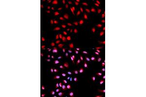 Immunofluorescence analysis of U2OS cells using Phospho-MET-Y1003 antibody (ABIN5969921). (c-MET 抗体  (pTyr1003))