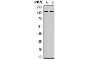 Western blot analysis of DNA Ligase 1 expression in 22RV1 (A), MCF7 (B) whole cell lysates. (LIG1 抗体  (N-Term))