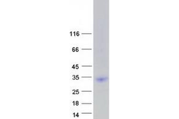 LRRN4CL Protein (Myc-DYKDDDDK Tag)