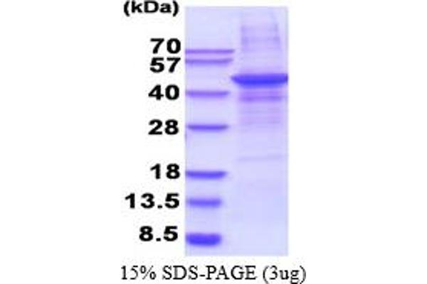 MMP28 Protein (AA 123-520) (His tag)