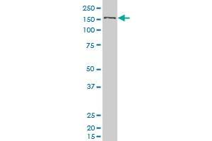 SMC1L1 polyclonal antibody (A01), Lot # 051003JC01 Western Blot analysis of SMC1L1 expression in 293 . (SMC1A 抗体  (AA 366-465))