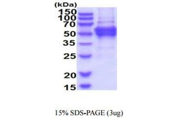 DPH2 Protein (AA 1-489) (His tag)