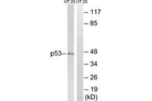 Western blot analysis of extracts from HT-29 cells, treated with calyculinA 50ng/ml 30', using p53 (Ab-376) Antibody. (p53 抗体  (AA 334-383))