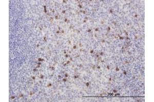 Image no. 3 for anti-Kv Channel Interacting Protein 2 (KCNIP2) (AA 1-100) antibody (ABIN466204) (KCNIP2 抗体  (AA 1-100))