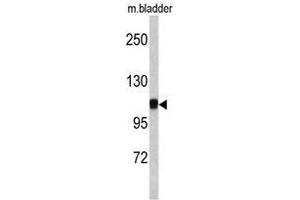 Image no. 1 for anti-Catenin (Cadherin-Associated Protein), alpha 1, 102kDa (CTNNA1) (N-Term) antibody (ABIN452886) (CTNNA1 抗体  (N-Term))