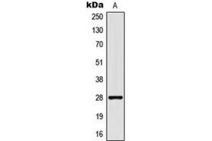 Western blot analysis of CD90 expression in MCF7 (A) whole cell lysates. (CD90 抗体  (Center))