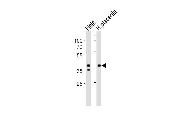 IDH3B 抗体  (N-Term)