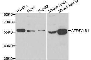 Western blot analysis of extracts of various cell lines, using ATP6V1B1 antibody (ABIN5975742) at 1/1000 dilution. (ATP6V1B1 抗体)