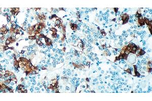 Normal human pituitary gland: immunohistochemical staining for Thyroid Stimulating Hormone. (TSH 抗体)