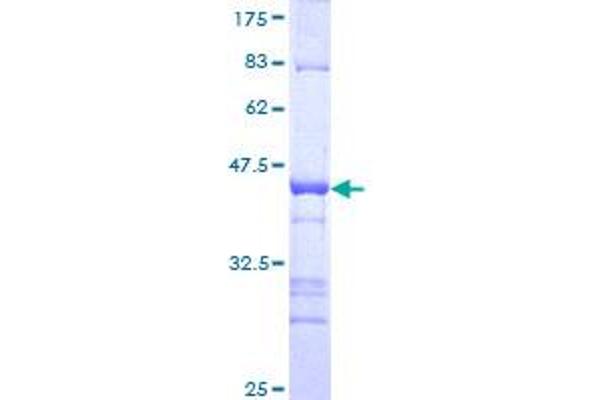 IKZF4 Protein (AA 2-108) (GST tag)