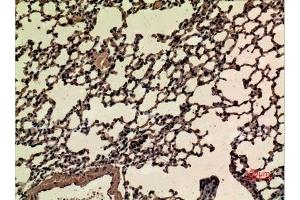 Immunohistochemical analysis of paraffin-embedded mouse-lung, antibody was diluted at 1:100. (NRF2 抗体  (acLys599))