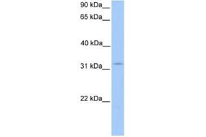 KCTD21 antibody used at 1 ug/ml to detect target protein. (KCTD21 抗体  (N-Term))