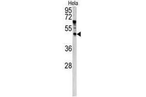 Image no. 1 for anti-Angiopoietin-Like 7 (ANGPTL7) (N-Term) antibody (ABIN452737) (ANGPTL7 抗体  (N-Term))