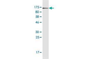 Western Blot detection against Immunogen (102. (CD44 抗体  (AA 1-699))