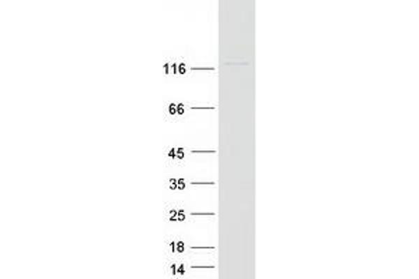 MGEA5 Protein (Transcript Variant 1) (Myc-DYKDDDDK Tag)