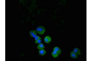Immunofluorescent analysis of MCF-7 cells using ABIN7164683 at dilution of 1: 100 and Alexa Fluor 488-congugated AffiniPure Goat Anti-Rabbit IgG(H+L) (PD-1 抗体  (AA 21-170))