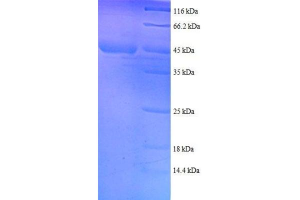 RPS18 Protein (AA 2-152, full length) (GST tag)