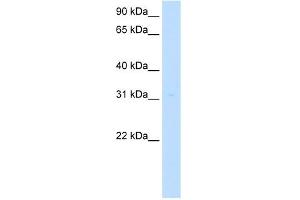 MLF2 antibody used at 5 ug/ml to detect target protein. (MLF2 抗体  (Middle Region))