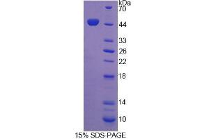 SDS-PAGE analysis of Human Integrin beta 1 Protein. (ITGB1 蛋白)