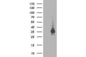 Western Blotting (WB) image for anti-ATG3 Autophagy Related 3 (ATG3) antibody (ABIN1496760) (ATG3 抗体)
