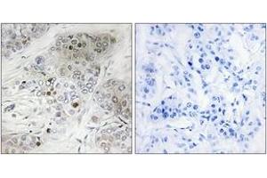 Immunohistochemistry (IHC) image for anti-Tumor Protein P53 (TP53) (pSer9) antibody (ABIN2888503) (p53 抗体  (pSer9))