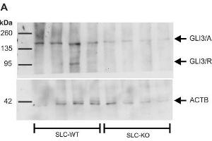 Western Blotting (WB) image for anti-GLI Family Zinc Finger 3 (GLI3) antibody (ABIN2855813)