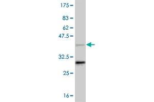 Western Blot detection against Immunogen (37. (NR4A2 抗体  (AA 147-250))