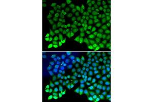Immunofluorescence analysis of MCF7 cell using RPA1 antibody. (RPA1 抗体)