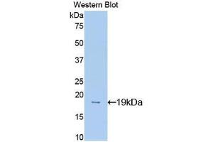 Western blot analysis of recombinant Mouse MK. (Midkine 抗体  (AA 22-140))