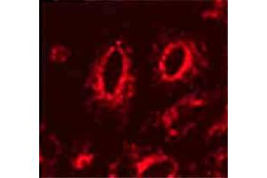 Image no. 1 for anti-Lysosomal-Associated Membrane Protein 1 (LAMP1) antibody (ABIN466916) (LAMP1 抗体)