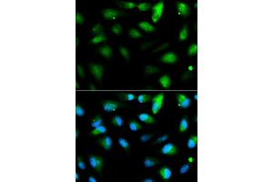 Immunofluorescence analysis of HeLa cells using F11R antibody (ABIN5970583). (F11R 抗体)